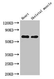 Western Blot Positive WB detected in: Mouse heart tissue, Mouse skeletal muscle tissue All lanes: CES1 antibody at 5µg/ml Secondary Goat polyclonal to rabbit IgG at 1/50000 dilution Predicted band size: 63 kDa Observed band size: 63 kDa