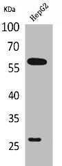 Western Blot analysis of HepG2 cells using GGT1 Polyclonal Antibody