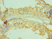 Immunohistochemistry of paraffin-embedded human testis tissue using CSB-PA005265DSR1HU at dilution of 1:100