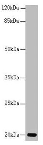 Western blot All lanes: CETN3 antibody at 1.77 ug/ml + Mouse gonadal tissue Secondary Goat polyclonal to rabbit IgG at 1/10000 dilution Predicted band size: 20 kDa Observed band size: 20 kDa