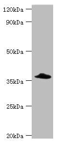 Western blot All lanes: Complement factor H-related protein 3 antibody at 6ug/ml + Rat heart tissue Secondary Goat polyclonal to rabbit IgG at 1/10000 dilution Predicted band size: 38, 31 kDa Observed band size: 38 kDa
