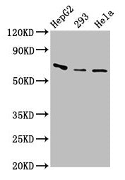 Western Blot Positive WB detected in: HepG2 whole cell lysate, 293 whole cell lysate, Hela whole cell lysate All lanes: CFI antibody at 3.2µg/ml Secondary Goat polyclonal to rabbit IgG at 1/50000 dilution Predicted band size: 66 kDa Observed band...