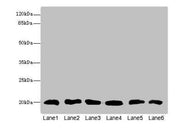 Western blot All lanes: CFL2 antibody at 3.75µg/ml Lane 1: Mouse brain tissue Lane 2: Mouse liver tissue Lane 3: Mouse lung tissue Lane 4: LO2 whole cell lysate Lane 5: Hela whole cell lysate Lane 6: A549 whole cell lysate Secondary Goat polyclona...