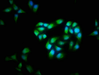 Immunofluorescence staining of Hela cells with CSB-PA005282LA01HU at 1:40, counter-stained with DAPI. The cells were fixed in 4% formaldehyde, permeabilized using 0.2% Triton X-100 and blocked in 10% normal Goat Serum. The cells were then incubate...