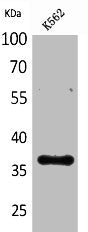 Western Blot analysis of K562 cells using CD207 Polyclonal Antibody