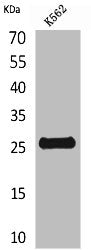 Western Blot analysis of K562 cells using CD161 Polyclonal Antibody