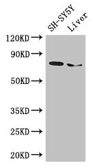 Western Blot Positive WB detected in: SH-SY5Y whole cell lysate, Mouse liver tissue All lanes: CHAT antibody at 3µg/ml Secondary Goat polyclonal to rabbit IgG at 1/50000 dilution Predicted band size: 83, 75, 71 kDa Observed band size: 75 kDa