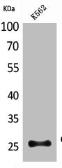 Western Blot analysis of K562 cells using CD201 Polyclonal Antibody