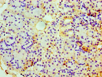 Immunohistochemistry of paraffin-embedded human pancreatic tissue using CSB-PA005344YA01HU at dilution of 1:100