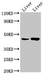 Western Blot Positive WB detected in: Rat liver tissue, Mouse liver tissue All lanes: CHKB antibody at 6.6ug/ml Secondary Goat polyclonal to rabbit IgG at 1/50000 dilution Predicted band size: 46, 14 kDa Observed band size: 46 kDa