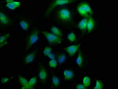 Immunofluorescence staining of U251 cells with CSB-PA005357LA01HU at 1:133, counter-stained with DAPI. The cells were fixed in 4% formaldehyde, permeabilized using 0.2% Triton X-100 and blocked in 10% normal Goat Serum. The cells were then incubat...