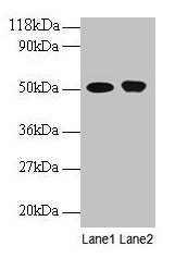 Western blot All lanes: ODC1 antibody at 2µg/ml Lane 1: EC109 whole cell lysate Lane 2: 293T whole cell lysate Secondary Goat polyclonal to rabbit IgG at 1/15000 dilution Predicted band size: 52 kDa Observed band size: 52 kDa
