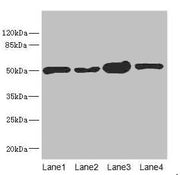Western blot All lanes: CHN1 antibody at 6.08µg/ml Lane 1: 293T whole cell lysate Lane 2: MCF-7 whole cell lysate Lane 3: Jurkat whole cell lysate Lane 4: Hela whole cell lysate Secondary Goat polyclonal to rabbit IgG at 1/10000 dilution Predicted...