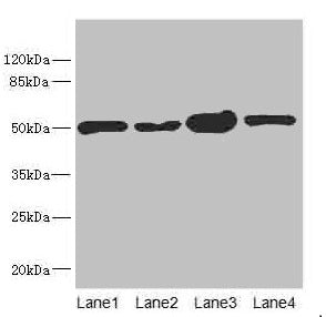 Western blot All lanes: CHN1 antibody at 6.08µg/ml Lane 1: 293T whole cell lysate Lane 2: MCF-7 whole cell lysate Lane 3: Jurkat whole cell lysate Lane 4: Hela whole cell lysate Secondary Goat polyclonal to rabbit IgG at 1/10000 dilution Predicted...