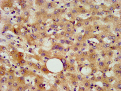 IHC image of CSB-PA005369LA01HU diluted at 1:800 and staining in paraffin-embedded human liver tissue performed on a Leica BondTM system. After dewaxing and hydration, antigen retrieval was mediated by high pressure in a citrate buffer (pH 6.0). S...