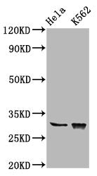 Western Blot Positive WB detected in: Hela whole cell lysate, K562 whole cell lysate All lanes: CHODL antibody at 6.2µg/ml Secondary Goat polyclonal to rabbit IgG at 1/50000 dilution Predicted band size: 31, 26, 28, 29 kDa Observed band size: 31 kDa