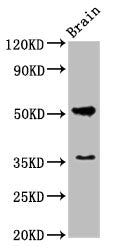 Western Blot Positive WB detected in: Rat brain tissue All lanes: Chrm1 antibody at 5.5µg/ml Secondary Goat polyclonal to rabbit IgG at 1/50000 dilution Predicted band size: 52 kDa Observed band size: 52 kDa