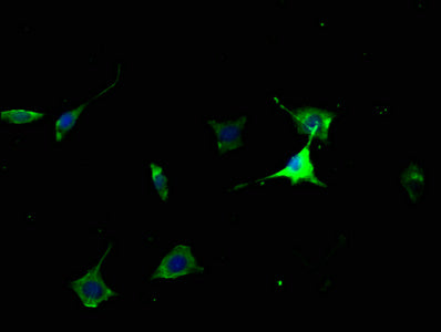 Immunofluorescence staining of SH-SY5Y cells with CSB-PA005382PA01HU at 1:50, counter-stained with DAPI. The cells were fixed in 4% formaldehyde, permeabilized using 0.2% Triton X-100 and blocked in 10% normal Goat Serum. The cells were then incub...