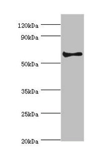 Western blot All lanes: Muscarinic acetylcholine receptor M3 antibody at 2ug/ml + Hela whole cell lysate Secondary Goat polyclonal to rabbit IgG at 1/10000 dilution Predicted band size: 66 kDa Observed band size: 66 kDa