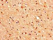 IHC image of CSB-PA005383LA01HU diluted at 1:400 and staining in paraffin-embedded human brain tissue performed on a Leica BondTM system. After dewaxing and hydration, antigen retrieval was mediated by high pressure in a citrate buffer (pH 6.0). S...