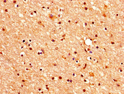 IHC image of CSB-PA005383LA01HU diluted at 1:400 and staining in paraffin-embedded human brain tissue performed on a Leica BondTM system. After dewaxing and hydration, antigen retrieval was mediated by high pressure in a citrate buffer (pH 6.0). S...