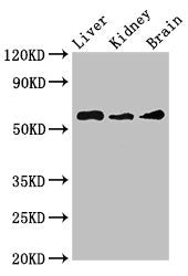 Western Blot Positive WB detected in: Mouse liver tissue, Mouse kidney tissue, Mouse brain tissue All lanes: CHRM5 antibody at 3.5ug/ml Secondary Goat polyclonal to rabbit IgG at 1/50000 dilution Predicted band size: 61 kDa Observed band size: 61 kDa