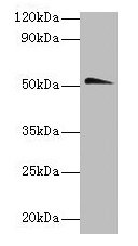 Western blot All lanes: Chrna1 antibody at 2µg/ml + Hela whole lysate Secondary Goat polyclonal to rabbit IgG at 1/10000 dilution Predicted band size: 52 kDa Observed band size: 52 kDa