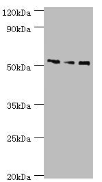 Western blot All lanes: Neuronal acetylcholine receptor subunit alpha-5 antibody at 12ug/ml Lane 1: Jurkat whole cell lysate Lane 2: A431 whole cell lysate Lane 3: A549 whole cell lysate Secondary Goat polyclonal to rabbit IgG at 1/10000 dilution...