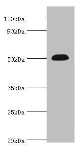 Western blot All lanes: Neuronal acetylcholine receptor subunit alpha-5 antibody at 12ug/ml + Jurkat whole cell lysate Secondary Goat polyclonal to rabbit IgG at 1/10000 dilution Predicted band size: 53 kDa Observed band size: 53 kDa