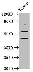 Western Blot Positive WB detected in: Jurkat whole cell lysate All lanes: CHRNB2 antibody at 6.05ug/ml Secondary Goat polyclonal to rabbit IgG at 1/50000 dilution Predicted band size: 58 kDa Observed band size: 58 kDa