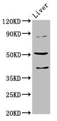 Western Blot Positive WB detected in: Mouse liver tissue All lanes: CHRNB3 antibody at 5.1ug/ml Secondary Goat polyclonal to rabbit IgG at 1/50000 dilution Predicted band size: 53 kDa Observed band size: 53 kDa