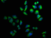 Immunofluorescence staining of Hela cells with CSB-PA005399LA01HU at 1:100, counter-stained with DAPI. The cells were fixed in 4% formaldehyde, permeabilized using 0.2% Triton X-100 and blocked in 10% normal Goat Serum. The cells were then incubat...