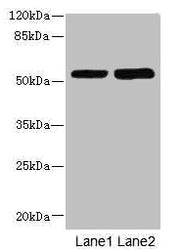 Western blot All lanes: CHRNE antibody at 1.87µg/ml Lane 1: Hela whole cell lysate Lane 2: HepG2 whole cell lysate Secondary Goat polyclonal to rabbit IgG at 1/10000 dilution Predicted band size: 55 kDa Observed band size: 55 kDa
