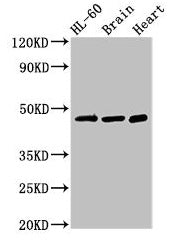 Western Blot Positive WB detected in: HL60 whole cell lysate, Mouse brain tissue, Rat heart tissue All lanes: CHST1 antibody at 3µg/ml Secondary Goat polyclonal to rabbit IgG at 1/50000 dilution Predicted band size: 47 kDa Observed band size: 47 kDa