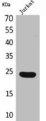 Western Blot analysis of Jurkat cells using IFN-ε Polyclonal Antibody