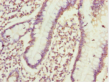 Immunohistochemistry of paraffin-embedded human small intestine tissue using CSB-PA005423ESR1HU at dilution of 1:100