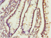 Immunohistochemistry of paraffin-embedded human small intestine tissue using CSB-PA005423ESR2HU at dilution of 1:100