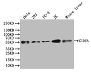 Western Blot Positive WB detected in: Hela whole cell lysate, 293 whole cell lysate, PC-3 whole cell lysate, JK whole cell lysate, Mouse Liver tissue lysate All lanes: CIDEA antibody at 1:1000 Secondary Goat polyclonal to rabbit IgG at 1/50000 dil...