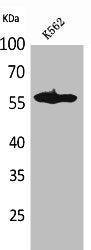 Western Blot analysis of K562 cells using Lyn Polyclonal Antibody