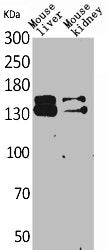 Western Blot analysis of mouse liver mouse kidney cells using RFC1 Polyclonal Antibody