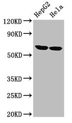 Western Blot Positive WB detected in: HepG2 whole cell lysate, Hela whole cell lysate All lanes: CKAP4 antibody at 2.7µg/ml Secondary Goat polyclonal to rabbit IgG at 1/50000 dilution Predicted band size: 67 kDa Observed band size: 67 kDa