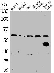 Western Blot analysis of MCF7 HepG2 293 mouse brain mouse lung cells using ZKSCAN4 Polyclonal Antibody