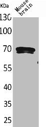 Western Blot analysis of mouse brain cells using Amphiphysin II Polyclonal Antibody