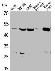 Western Blot analysis of A549 HT29 K562 mouse kidney mouse lung cells using GDI-2 Polyclonal Antibody