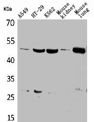 Western Blot analysis of A549 HT29 K562 mouse kidney mouse lung cells using GDI-2 Polyclonal Antibody