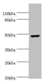 Western blot All lanes: CKMT2 antibody at 6ug/ml + Hela whole cell lysate Secondary Goat polyclonal to rabbit IgG at 1/10000 dilution Predicted band size: 48 kDa Observed band size: 48 kDa