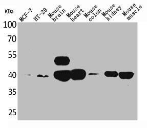 Western Blot analysis of MCF-7 HT29 mouse brain mouse heart mouse colon mouse kidney mouse skeletal muscle cells using IDH3A Polyclonal Antibody