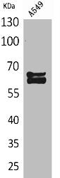 Western Blot analysis of A549 cells using NUMB Polyclonal Antibody