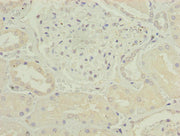 Immunohistochemistry of paraffin-embedded human kidney tissue using CSB-PA005468LA01HU at dilution of 1:100