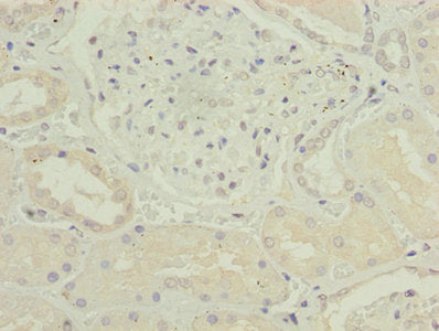 Immunohistochemistry of paraffin-embedded human kidney tissue using CSB-PA005468LA01HU at dilution of 1:100